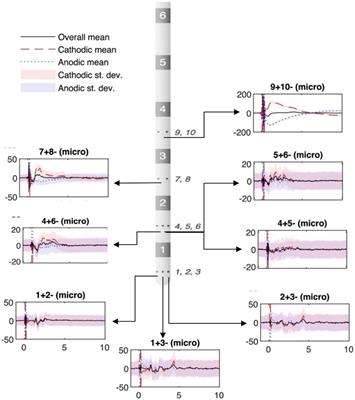 What is the effect of benzodiazepines on deep brain activity? A study in pediatric patients with dystonia